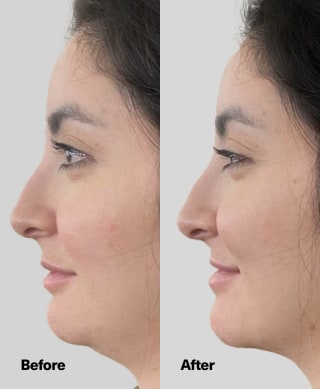 SickScience ShapeShift Jaw Defining Serum